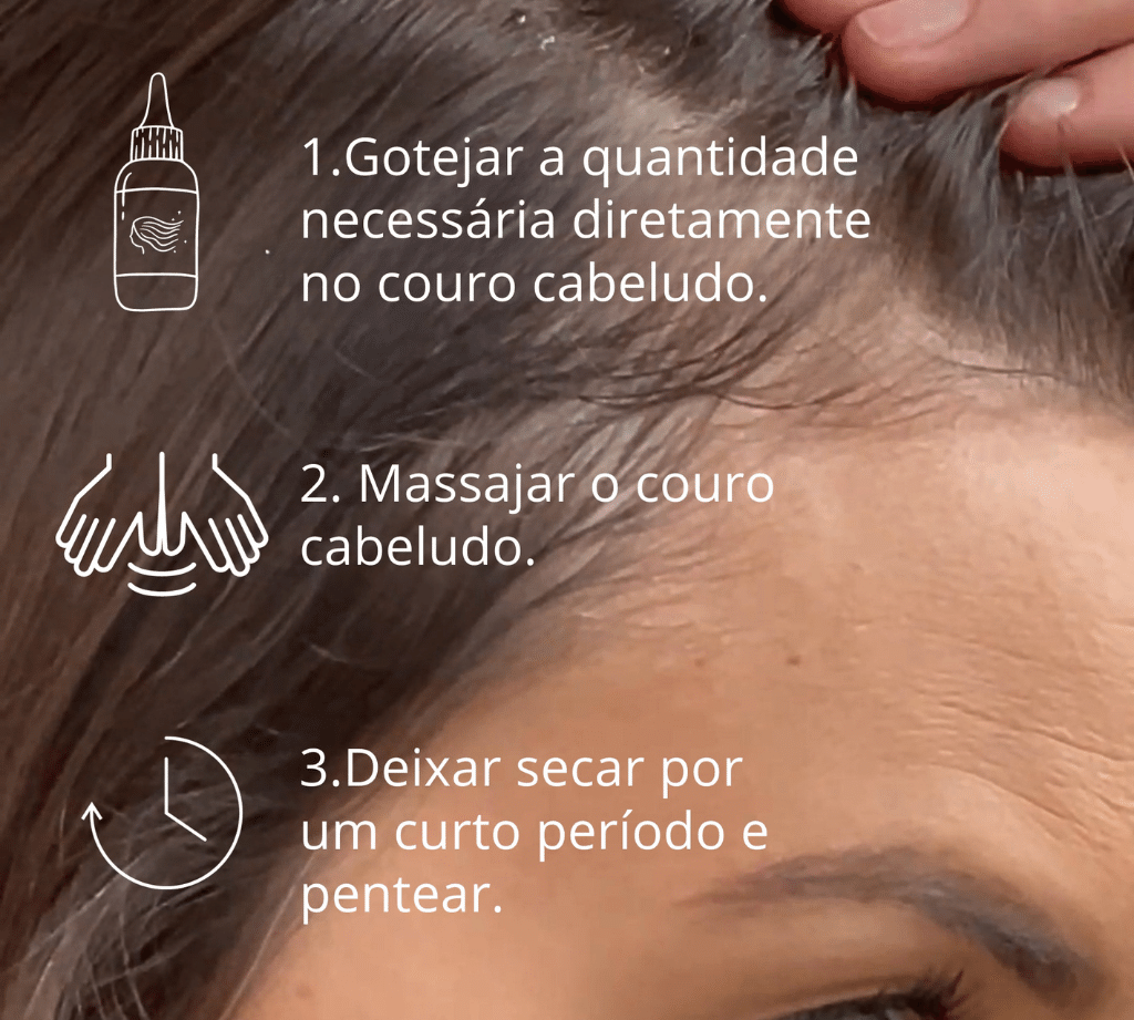 Sensiderm Scalp Tonic Capilar - Couro cabeludo sensível, Anti-caspa - All 2 Skin
