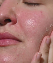 Triple Effect Peeling - Esfoliante facial AHA's, enzimas e partículas naturais